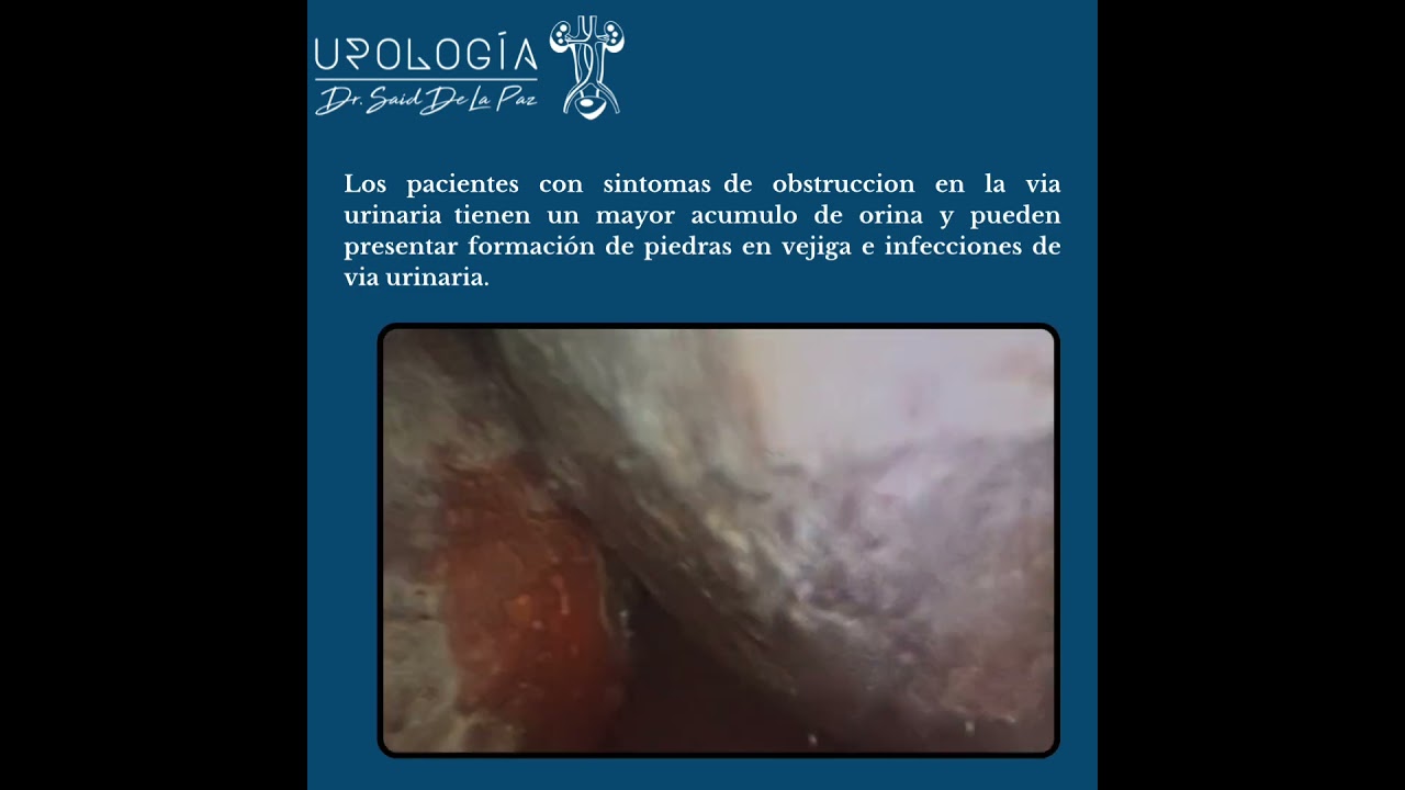 Said De La Paz Martinez-14