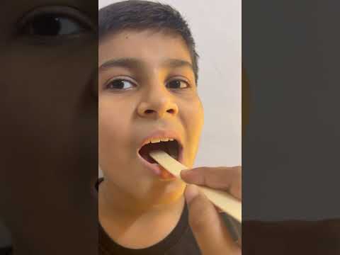 “k” Sound || Misarticulation || Speech Clarity || Oral Placement Therapy||  #speechclarity #tongue