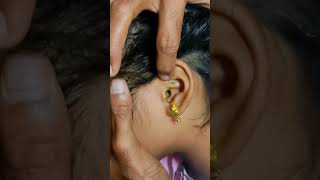 Download lagu ||Quick remedy for ear pain||Dr.Yogaanand||#acupuncture #siddha #cure #earpain #Dr.Yogaanand mp3 Download lagu ||Quick remedy for ear pain||Dr.Yogaanand||#acupuncture #siddha #cure #earpain #Dr.Yogaanand mp3