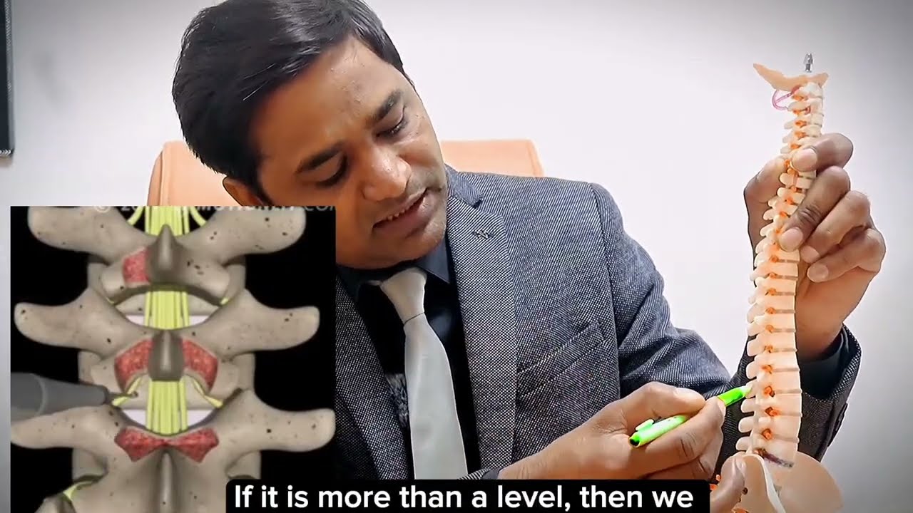 What is Endoscopic Spine Surgery | Procedure | Treatment |  Benefits | - Dr . Manohar Kanwaria