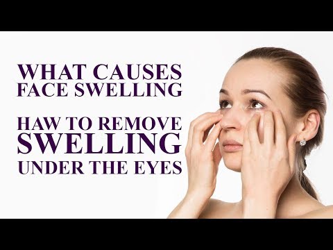 Swelling of the face is the cause of clear fluid leakage. Swelling remove. Swelling remove. Swelling remove. Swelling remove.