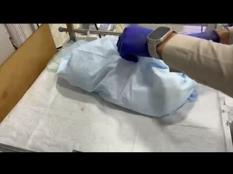 30 Weeks Premature Baby 👶 | Peripheral Cyanosis & Early Cry | NICU Care & Observation 💉 #newborncare