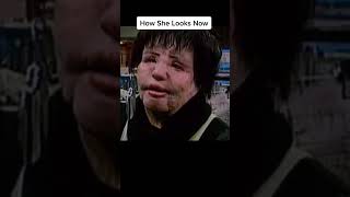 Download lagu How people look before and after plastic surgery😵 #shorts mp3 Download lagu How people look before and after plastic surgery😵 #shorts mp3