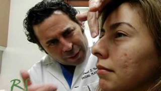 Ninguna cicatriz Cerrado Rinoplastia Nariz Job – No Scar Closed Rhinoplasty Nose Job