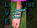 Longest Vein Ever The Great Saphenous Vein Check Shorts