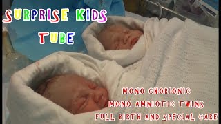 FLASH BACK MONO CHORIONIC MONO AMNIOTIC TWINS FULL BIRTH AND SPECIAL CARE 2008