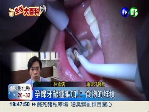 荷爾蒙作怪! 孕婦產後掉4顆牙