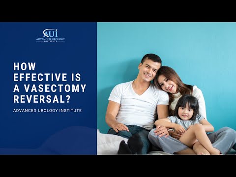 How successful is a vasectomy reversal – Dr. Yaser Bassel