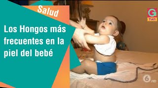 Los hongos más frecuentes en la piel del bebé | Salud