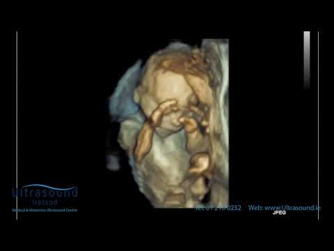 Scan of the Week: 22 Week Well Baby Scan