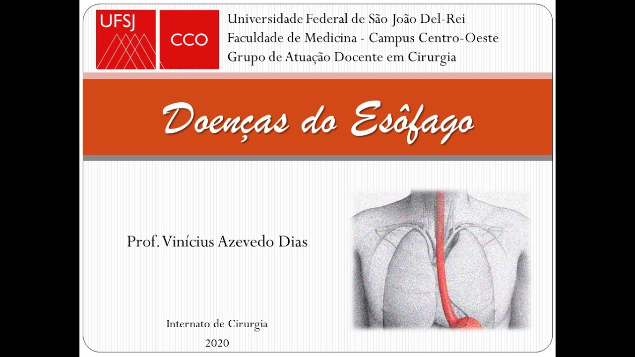 Doenças do esôfago - Internato de Cirurgia - UFSJ CCO