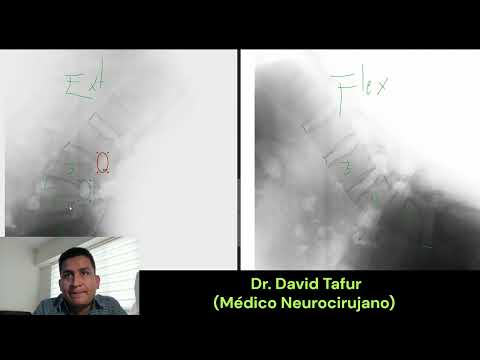 David Tafur Muñoz-3538