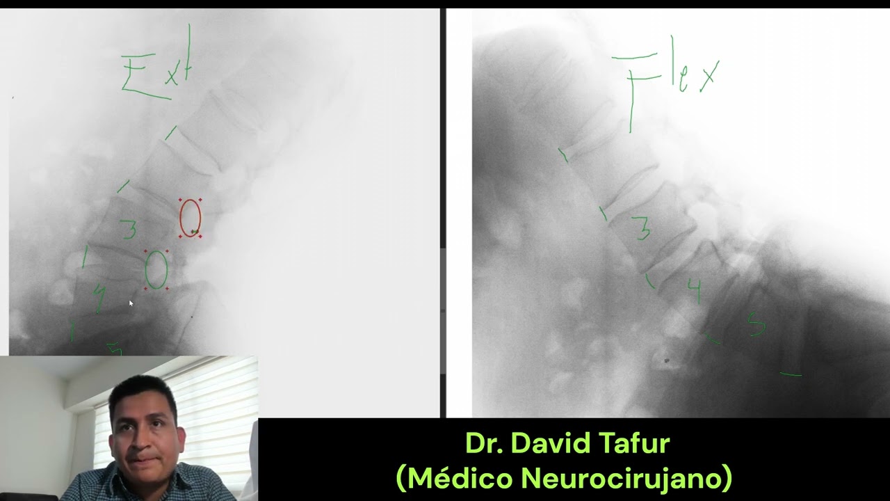 David Tafur Muñoz-2472