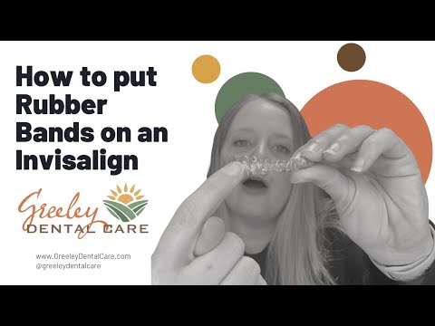 How to put Rubberbands on your Invisilign