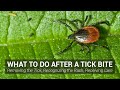 What to Do After a Tick Bite - Johns Hopkins Lyme Disease Research Center