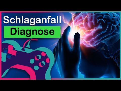 Schlaganfall-Therapie: Ungewöhnliches Potenzial mit Videospielen! Neuroplastizität spielend fördern