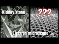 Electron Microscope Images Top 15 Best Electron Microscope Images Stunning Microscope Images