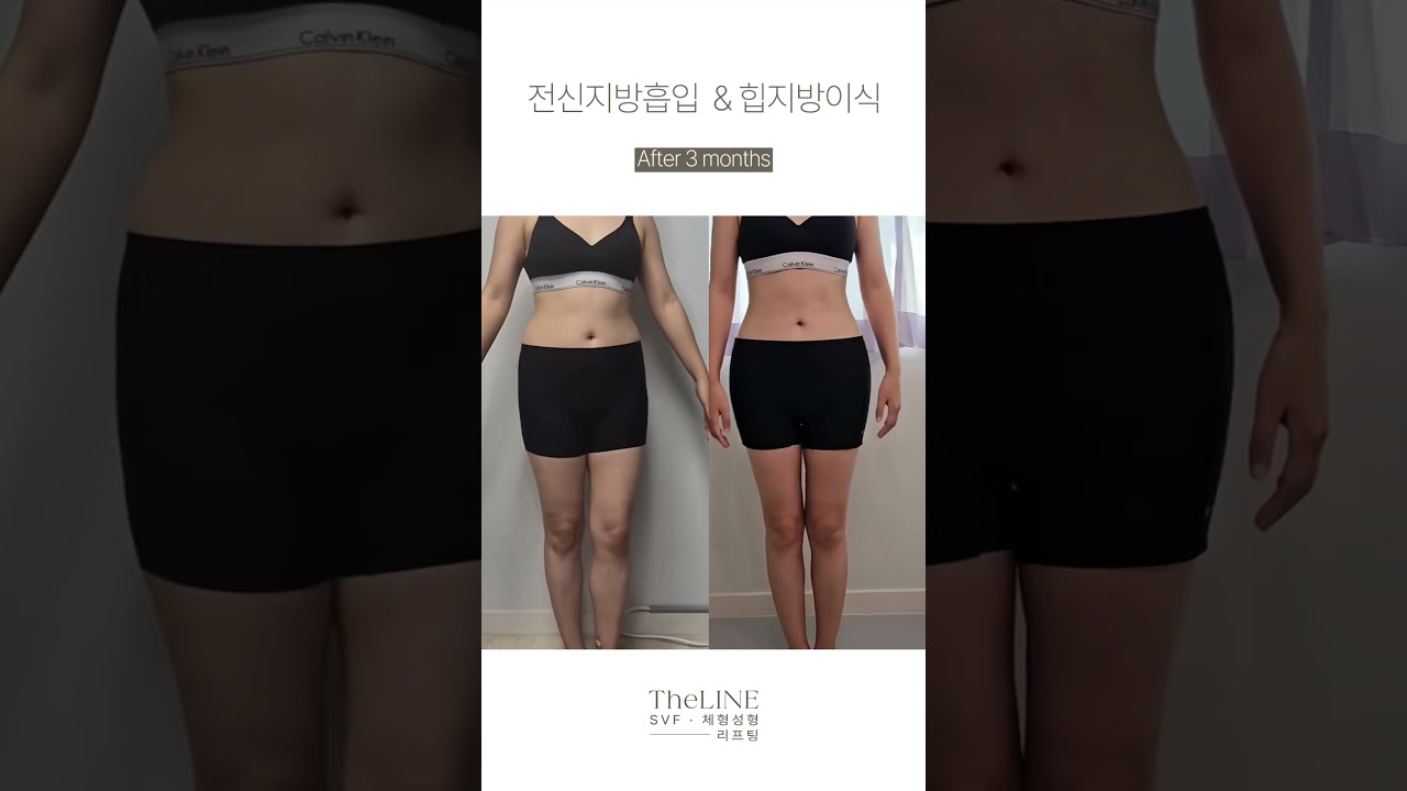 더라인 쇼츠 영상