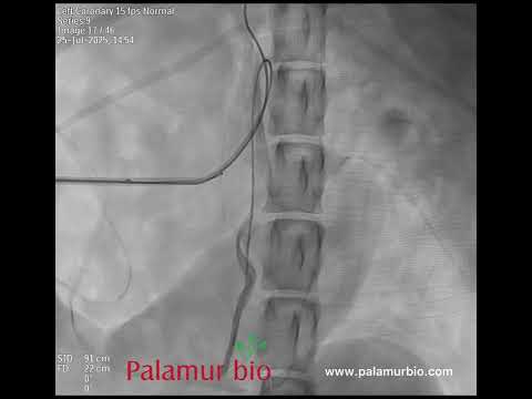 𝗠𝘂𝗹𝘁𝗶-𝘀𝗶𝘁𝗲 𝗦𝗽𝗹𝗮𝗻𝗰𝗵𝗻𝗶𝗰 𝗩𝗲𝗶𝗻 𝗦𝗮𝗺𝗽𝗹𝗶𝗻𝗴 𝗶𝗻 𝗮𝗻 𝗜𝗺𝗮𝗴𝗶𝗻𝗴-𝗘𝗻𝗮𝗯𝗹𝗲𝗱 𝗖𝗮𝗻𝗶𝗻𝗲 𝗣𝗞 𝗦𝘁𝘂𝗱𝘆 𝗯𝘆 𝗣𝗮𝗹𝗮𝗺𝘂𝗿 𝗕𝗶𝗼𝘀𝗰𝗶𝗲𝗻𝗰𝗲𝘀