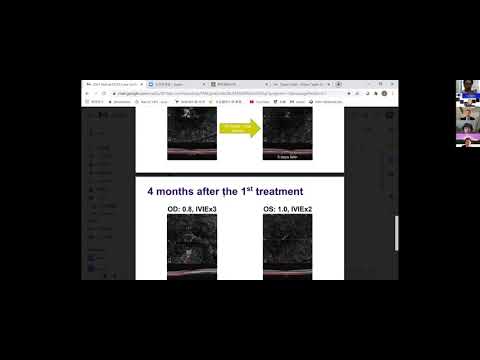 YouTube video