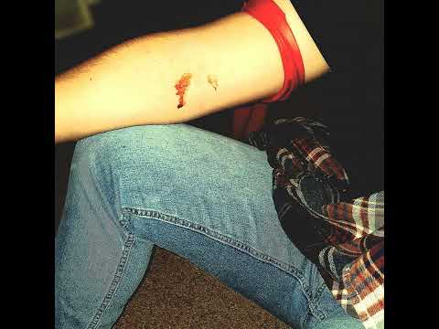 Relapse - definite maybe.