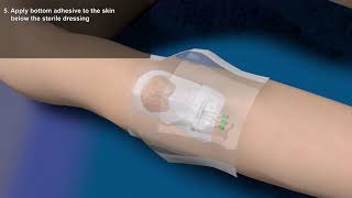 Product video: HydroSeal Waterproof Shower Cover & IV Sleeve Protector