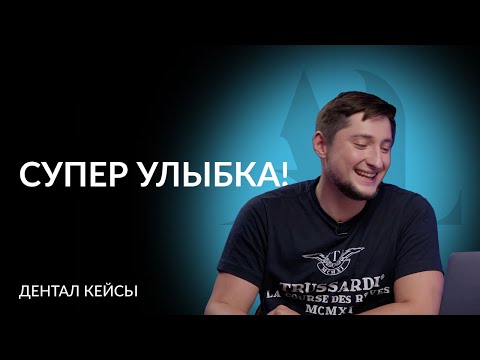 Артур Лукьяненко | ДенталКейсы | Супер улыбка!
