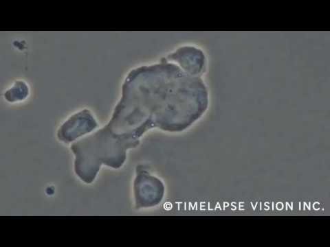 カモフラージュの達人である細胞: がんはどのように発生するのでしょうか?