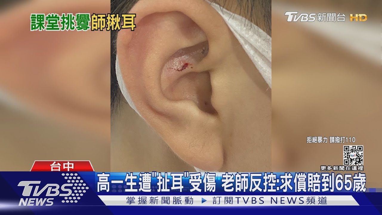 高一生遭「扯耳」受傷 老師反控:求償賠到65歲