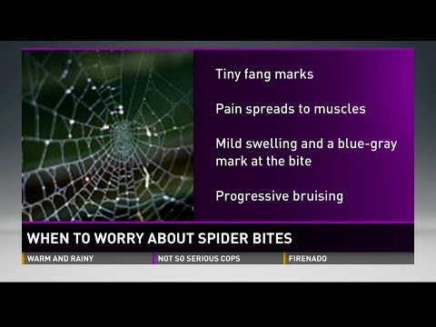 When To Worry About Spider Bites - Pediatric Expert Tips