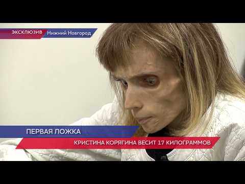 Страдающая анорексией Барнаулка начала принимать пищу в Нижнем Новгороде