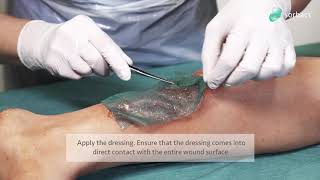 How to use - Sorbact Gel