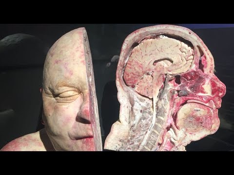 Gerçek İnsan Vücudu Müzesi Body Worlds