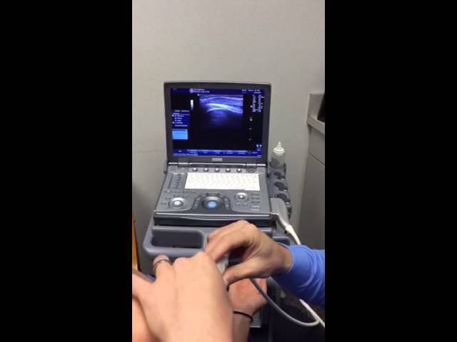 Ultrasound Exam of the Shoulder