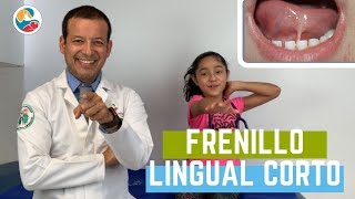 FRENILLO LINGUAL CORTO