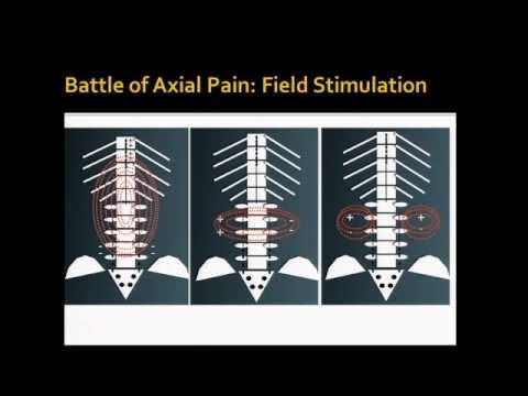 Neural Prothesis Seminar - Krishna Kumar, MD