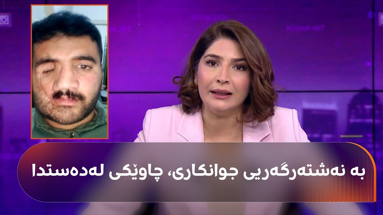 ڤیدیۆ | ئەم گەنجە بەهۆی هەڵەی پزیشکییەوە لەکاتی نەشتەرگەریی جوانکاریی لووت، رووخساری شێواوە