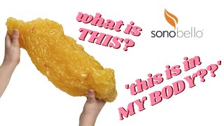 what is THIS | Sonobello