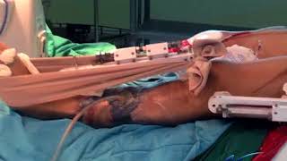 Claro que se puede: Doctor dominicano inventa fijador externo accesible a los más pobres