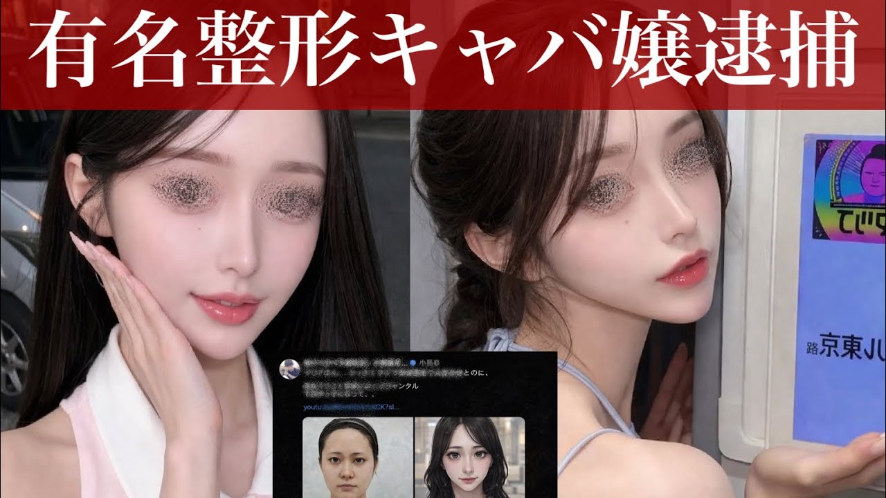 目フル鼻フル済みのおジャングル東京のキャバ嬢が中国で💊所持で逮捕された事に便乗して過去の脂肪吸引モニターの写真を人質かのように引っ張り出して宣伝をした直美理事長さん、無事炎上する