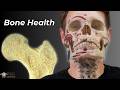 How Diet Exercise Changes Your Bones