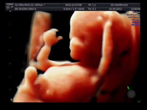 Kako izgleda beba u desetoj nedelji trudnoce - Analife