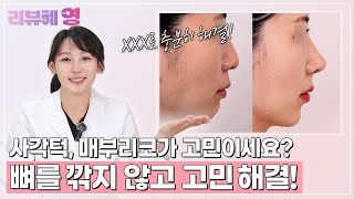 [리뷰혜영] 사각턱과 메부리코는 XXX 시술로 개선 가능!✨ l 와이영성형외과