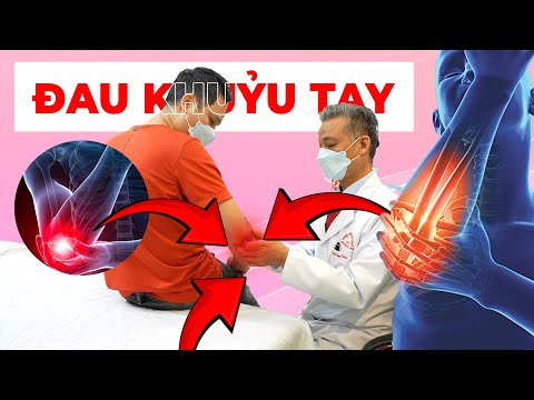 Khám Phá Cách Đánh Bay Cơn Đau Khuỷu Tay Không Cần Phẫu Thuật