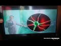 Dolo Neurobion Commercial 2020