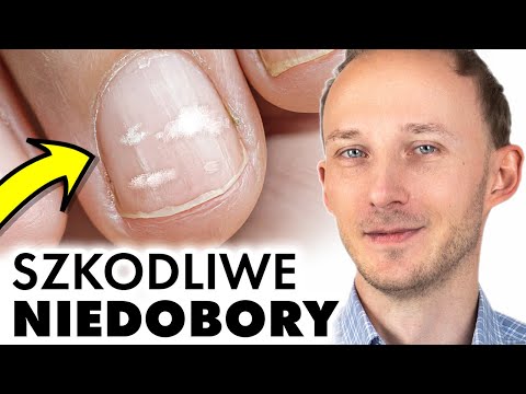 , title : '5 groźnych niedoborów w diecie Polaków! Masz je? Mogą zrujnować Twoje zdrowie | Dr Bartek Kulczyński'