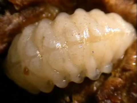 Articolazioni Butakova Video Come lei al massaggio osteocondrosi
