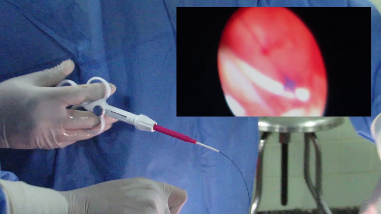 Wilson Pedro Pereyra Velasquez-38