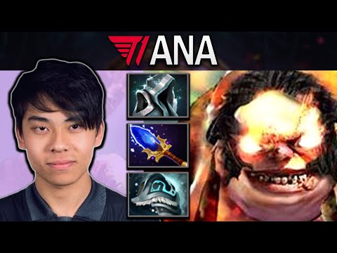 Pudge Dota 2 Gameplay T1.Ana with 25 Kills and Tarasque - Aghanims #dota2 #dota2gameplay