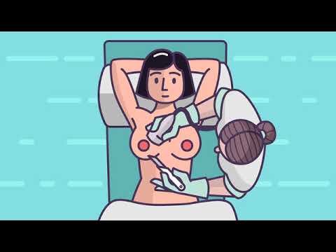 Bard Vacuum Assisted Biopsy VAB 2